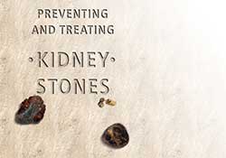 Preventing and Treating Kidney Stones